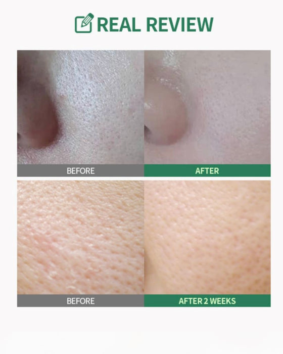 [ SUNGBOON EDITOR ] Green Tomato Pore Lifting Ampoule + 30mL