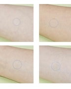 [ Madecassol ] Madeca Medi Patch ACQ 122 Counts