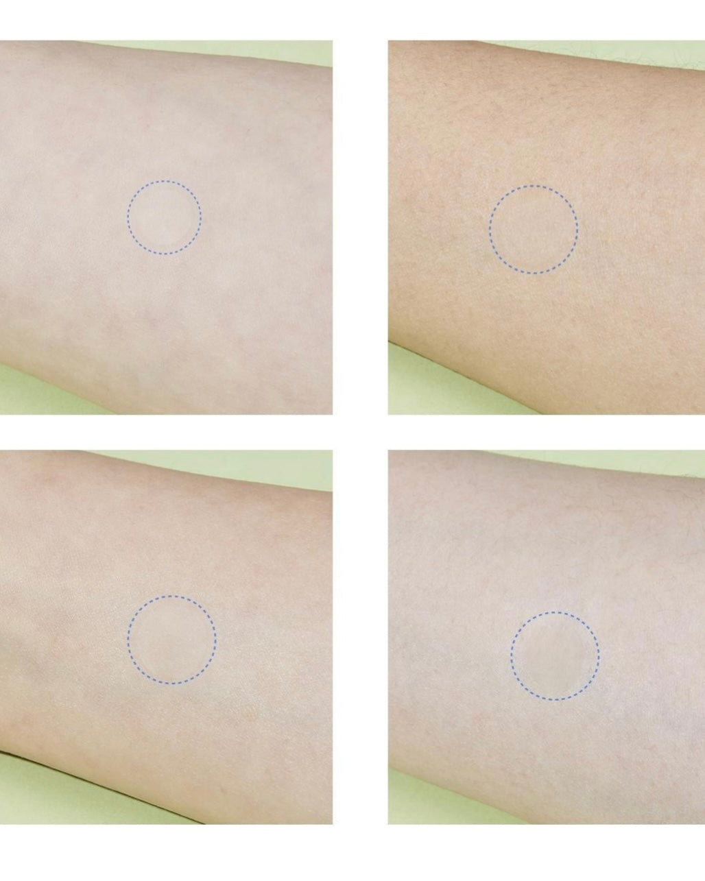 [ Madecassol ] Madeca Medi Patch ACQ 122 Counts